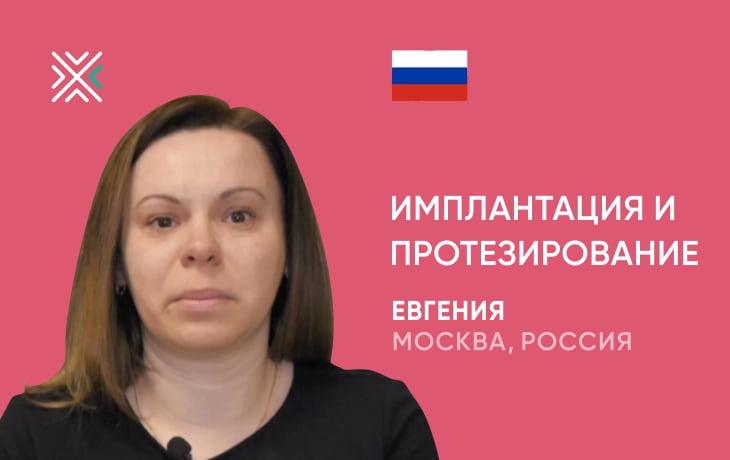 Отзыв Евгения из Москвы об имплантации и протезировании в клинике kANO, Минск