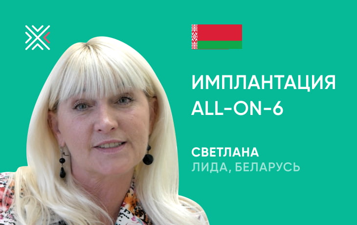 Отзыв об имплантации All-on-6 в Минске, клиника KANO