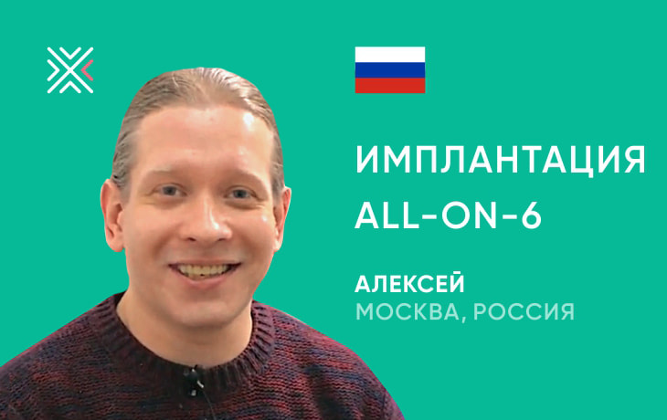 Рок музыкант об имплантации All-on-6